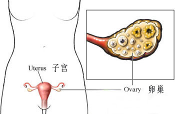 卵巢早衰治疗