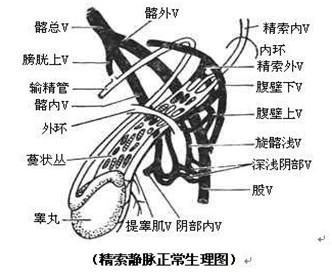 精索静脉曲张的检查项目有哪些