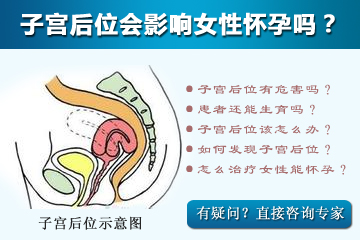 子宫后位