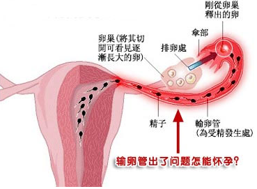 武汉女性输卵管堵塞的原因有哪些？