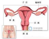子宫肌瘤不好治疗吗?