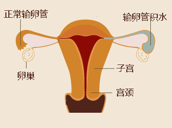 子宫内膜厚度是多少才正常?