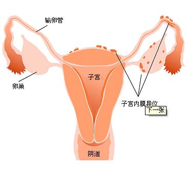 子宫内膜厚度的因素