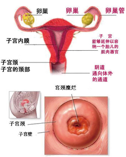 宫颈糜烂真的是宫颈糜烂了?