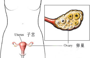 卵巢囊肿的复发率